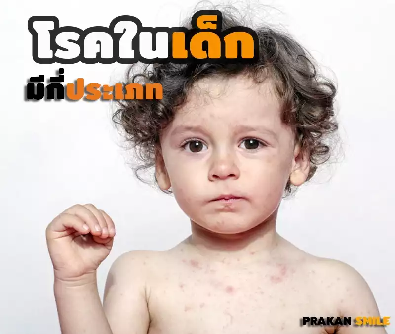โรคเด็ก คืออะไร